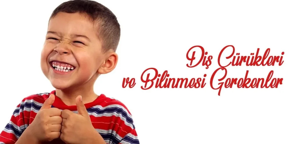Diş Çürükleri Hakkında Bilinmesi Gerekenler!